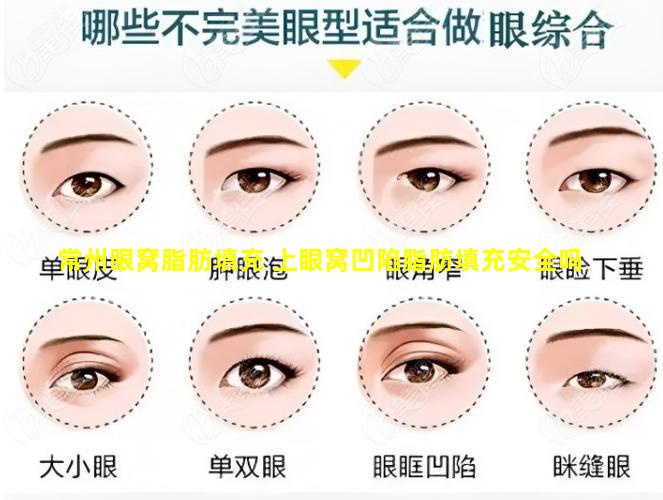 常州眼窝脂肪填充 上眼窝凹陷脂肪填充安全吗